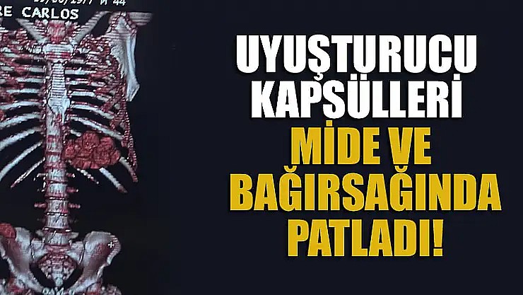 Midesinde taşıdığı uyuşturucu kapsülleri patladı!